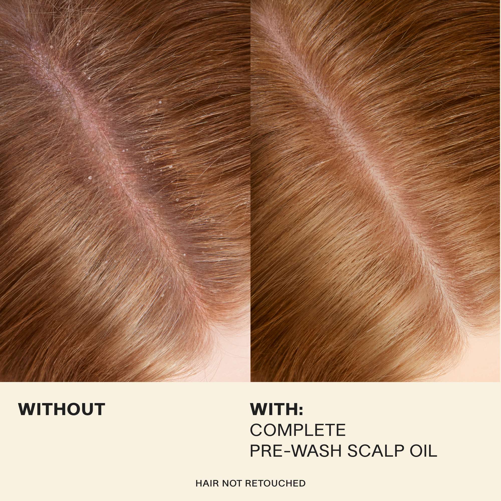 Complete Pre-Wash Scalp Oil - Image 5